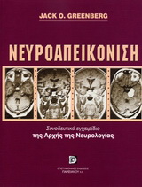Νευροαπεικόνιση