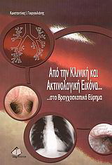 Από την κλινική και ακτινολογική εικόνα …στο βρογχοσκοπικό εύρημα
