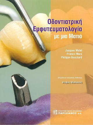 Οδοντιατρική Εμφυτευματολογία με μια Μάτια
