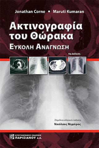 Ακτινογραφία του Θώρακα