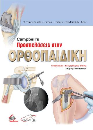 Campbell’s Προσπελάσεις στην Ορθοπαιδική