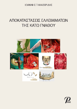 ΑΠΟΚΑΤΑΣΤΑΣΕΙΣ ΕΛΛΕΙΜΑΤΩΝ ΤΗΣ ΚΑΤΩ ΓΝΑΘΟΥ