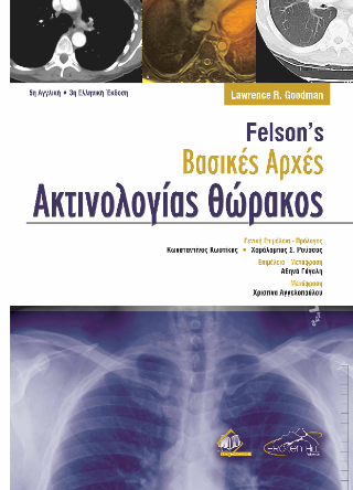 Felson’s Βασικές Αρχές Ακτινολογίας Θώρακος
