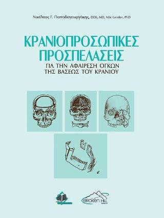 Κρανιοπροσωπικές Προσπελάσεις για την Αφαίρεση Όγκων της Βάσεως του Κρανίου